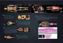 Digihuman Virtual Anatomy Table-5