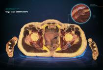 ECDH-INT II 88 HD HUMAN VIRTUAL ANATOMY TABLE-4