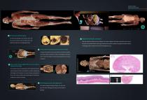 ECDH-INT II 88 HD HUMAN VIRTUAL ANATOMY TABLE-5