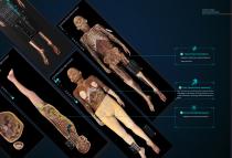 ECDH-INT II 88 HD HUMAN VIRTUAL ANATOMY TABLE-6