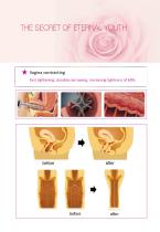 co2 fractional laser - 9