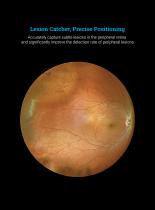 Retinal camera wide field -3