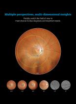 Retinal camera wide field -5