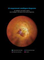 Retinal camera wide field -8