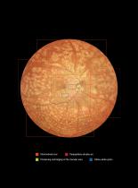 Retinal camera wide field -9