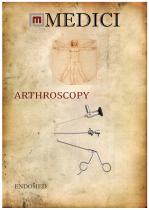 ARTHROSCOPY