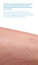 VARIXIO brochure: Treatment of varicose veins with sclerotherapy-2