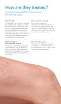 VARIXIO brochure: Treatment of varicose veins with sclerotherapy-3