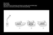 VRN DS-100 Dental Bone Surgery-12