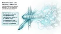 I-BONE BIOABSORBABLE PINS by ORTHOSYN-2