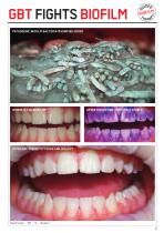 CLEAN TEETH HEALTHY BODY-7