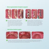 Bona-aid-6