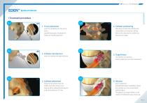 EDEN™ Kyphoplasty Balloon System-4