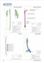Interlocking Nailing System-4
