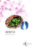 DETECT IF P carinii (FIPC200) - 1