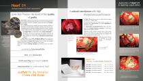 Heart DM neurosurgery-2