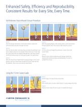 Carter-Thomason II Port Site Closure System - 5