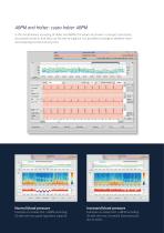Holter ECG-11