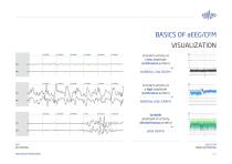 ELMIKO aEEG/CFM EEG Digi Track-14