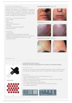 LASEmaR® 1500 - 3