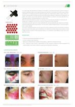 LASEmaR® 500-2