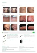 LASEmaR® 500-5