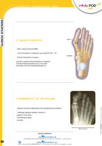Forefoot operative technique-2