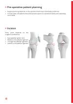 CTN - Cannulated Tibia Nail - 10