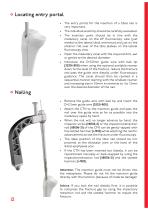 CTN - Cannulated Tibia Nail - 12