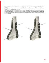 DHL - Distal Humeral Locking Plates - 13