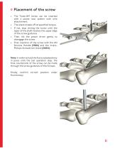 TOS Twist-Off Screw - 11