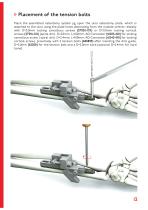 UOL - Ulna Osteotomy Locking Plate - 13