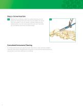 capture high-torque surgical-8