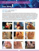 DIABETIC SKIN ULCER-2