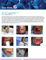 DIABETIC SKIN ULCER-8