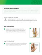 Integra® Reinforcement Matrix-2