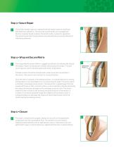 Integra® Reinforcement Matrix-3