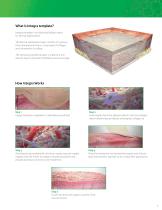 Integra® Tissue Technologies - 3