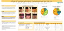 MediHoney® Poster - Aballay Partial Thickness Facial Burns-1