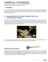 M.T.P. arthrodesis Hallu®-Fix system-3