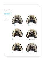 Orthodontic - Anchor Plate System - 2