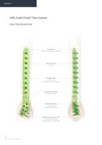 Orthopedic - ARIX Ankle System - 3.5 Distal Tibia - 6