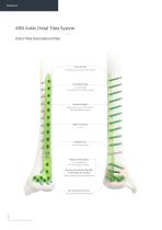 Orthopedic - ARIX Ankle System - 3.5 Distal Tibia - 8