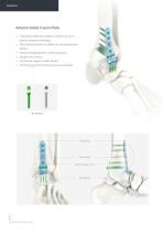 Orthopedic - ARIX Ankle System - Distal Tibia SMO and Fusion - 10