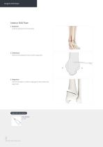 Orthopedic - ARIX Ankle System - Distal Tibia SMO and Fusion - 16