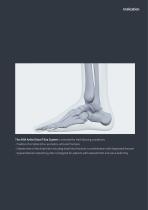Orthopedic - ARIX Ankle System - Distal Tibia SMO and Fusion - 3