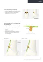 Orthopedic - ARIX Ankle System - Distal Tibia SMO and Fusion - 7