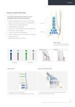 Orthopedic - ARIX Ankle System - Distal Tibia SMO and Fusion - 9