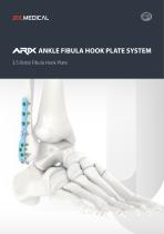 Orthopedic - ARIX Ankle System - Fibula Hook Plate - 1