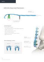 Orthopedic - ARIX Ankle System - Fibula Hook Plate - 4